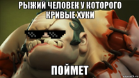 рыжий человек у которого кривые хуки поймет