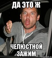 да это ж челюстной зажим