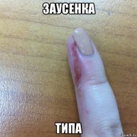 заусенка типа