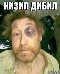 кизил дибил 