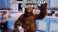 я поранил коленку! идите поцелуйте! 