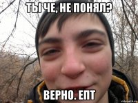 ты че, не понял? верно. епт