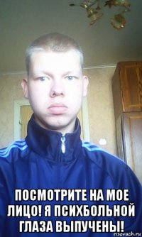  посмотрите на мое лицо! я психбольной глаза выпучены!