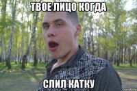 твое лицо когда слил катку