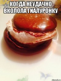 когда неудачно вколола гиалуронку 