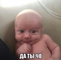  да ты чо