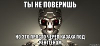 ты не поверишь но это просто череп казаха под рентгеном