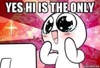 yes hi is the only 