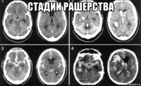 стадии рашерства 