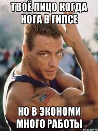 твоё лицо когда нога в гипсе но в экономи много работы