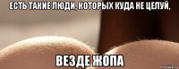 есть такие люди, которых куда не целуй, везде жопа