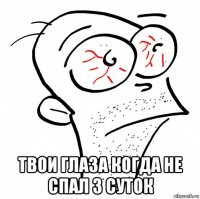  твои глаза когда не спал 3 суток