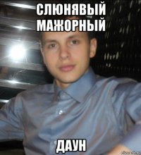 слюнявый мажорный даун