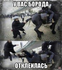 у вас борода отклеилась