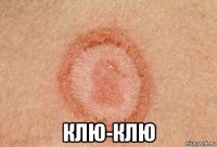  клю-клю