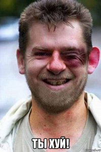  ты хуй!