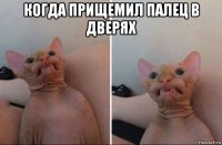 когда прищемил палец в дверях 