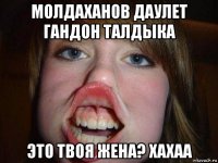 молдаханов даулет гандон талдыка это твоя жена? хахаа