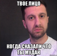 твое лицо когда сказали что ты мудак