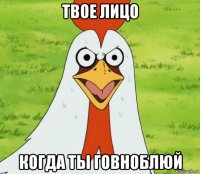 твое лицо когда ты говноблюй