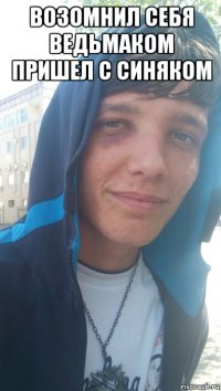 возомнил себя ведьмаком пришел с синяком 