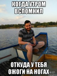 когда утром вспомнил откуда у тебя ожоги на ногах