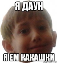 я даун я ем какашки