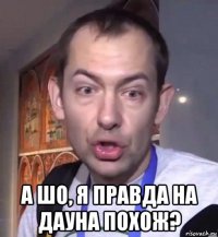  а шо, я правда на дауна похож?