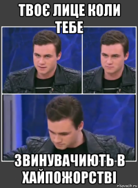 твоє лице коли тебе звинувачиють в хайпожорстві