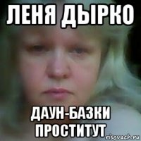 леня дырко даун-базки проститут