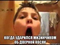  когда ударился мизинчиком об дверной косяк