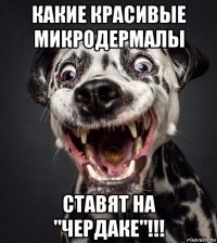 какие красивые микродермалы ставят на "чердаке"!!!