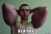  ну и лох