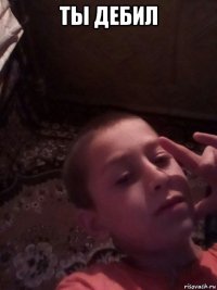 ты дебил 