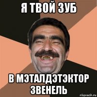 я твой зуб в мэталдэтэктор звенель