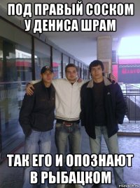 под правый соском у дениса шрам так его и опознают в рыбацком