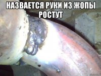 назвается руки из жопы ростут 