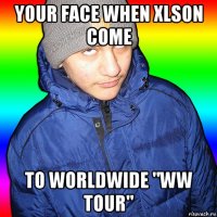 your face when xlson come to worldwide "ww tour"