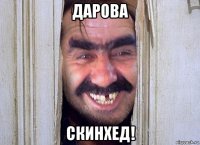 дарова скинхед!