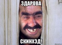 здарова скинхэд!