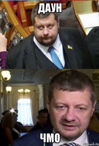 даун чмо