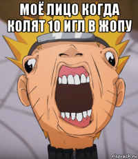 моё лицо когда колят 10 игл в жопу 