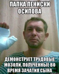 папка пениски осипова демонструет трудовые мозоли, полученные во время зачатия сына