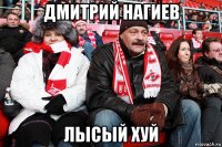 дмитрий нагиев лысый хуй