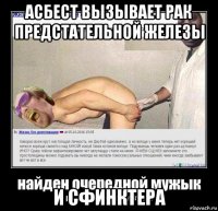 асбест вызывает рак предстательной железы и сфинктера