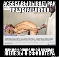 асбест вызывает рак предстательной железы и сфинктера