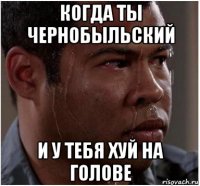 когда ты чернобыльский и у тебя хуй на голове