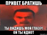 привет братишь ты видишь мой глаз?! ой ты идиот