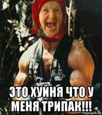  это хуйня что у меня трипак!!!