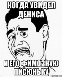 когда увидел дениса и его фимозную писюньку